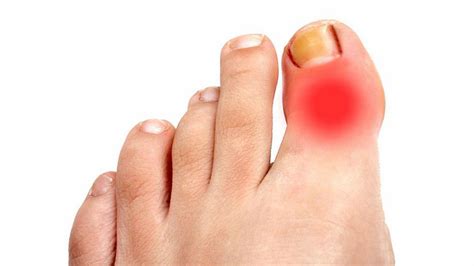 Боль в суставе правого пальца ноги - причины и способы лечения